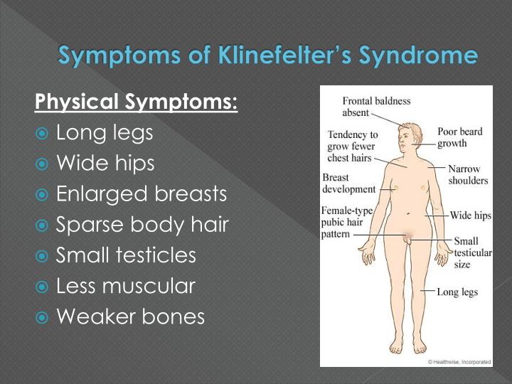 Ppt Klinefelters Syndrome Powerpoint Presentation Id 963511