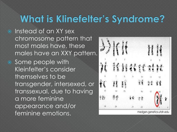 Ppt - Klinefelter U2019s Syndrome Powerpoint Presentation