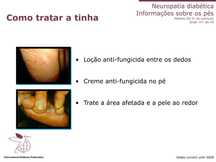 Se um prego preto em tratamento de mãos