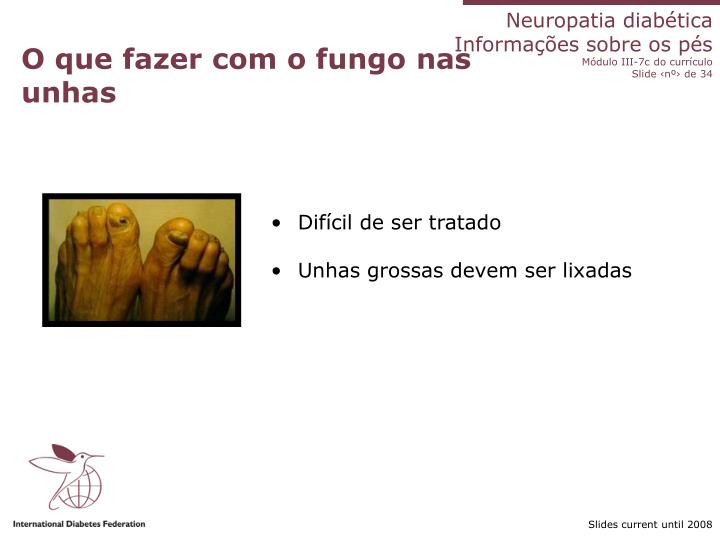 Granuloma em um tratamento de prego por remédios de gente