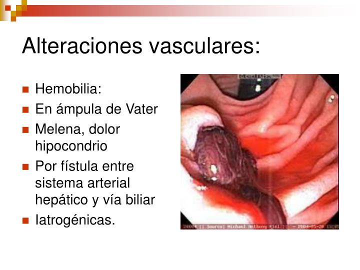 Si es posible aumentar el pecho sobre las hierbas