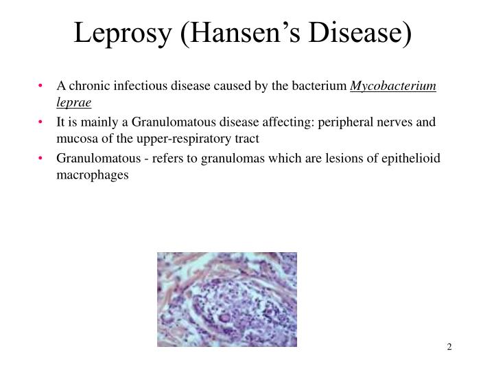 chronic and infectious disease paper Monday, may 08, 2017 thinking beyond the diagnosis: pts and infectious disease response - a q&a with michel landry, bscpt, phd zika virus is back in the news, as new cases have now been reported in texas, according to the centers for disease control and prevention (cdc), which estimates that 1 in 10 women who contracted. chronic and infectious disease paper Monday, may 08, 2017 thinking beyond the diagnosis: pts and infectious disease response - a q&a with michel landry, bscpt, phd zika virus is back in the news, as new cases have now been reported in texas, according to the centers for disease control and prevention (cdc), which estimates that 1 in 10 women who contracted.