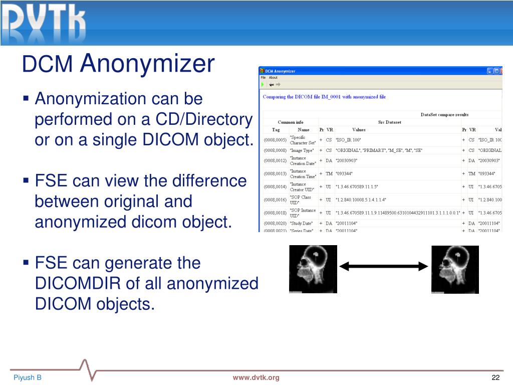 view dicomdir file view dicomdir file