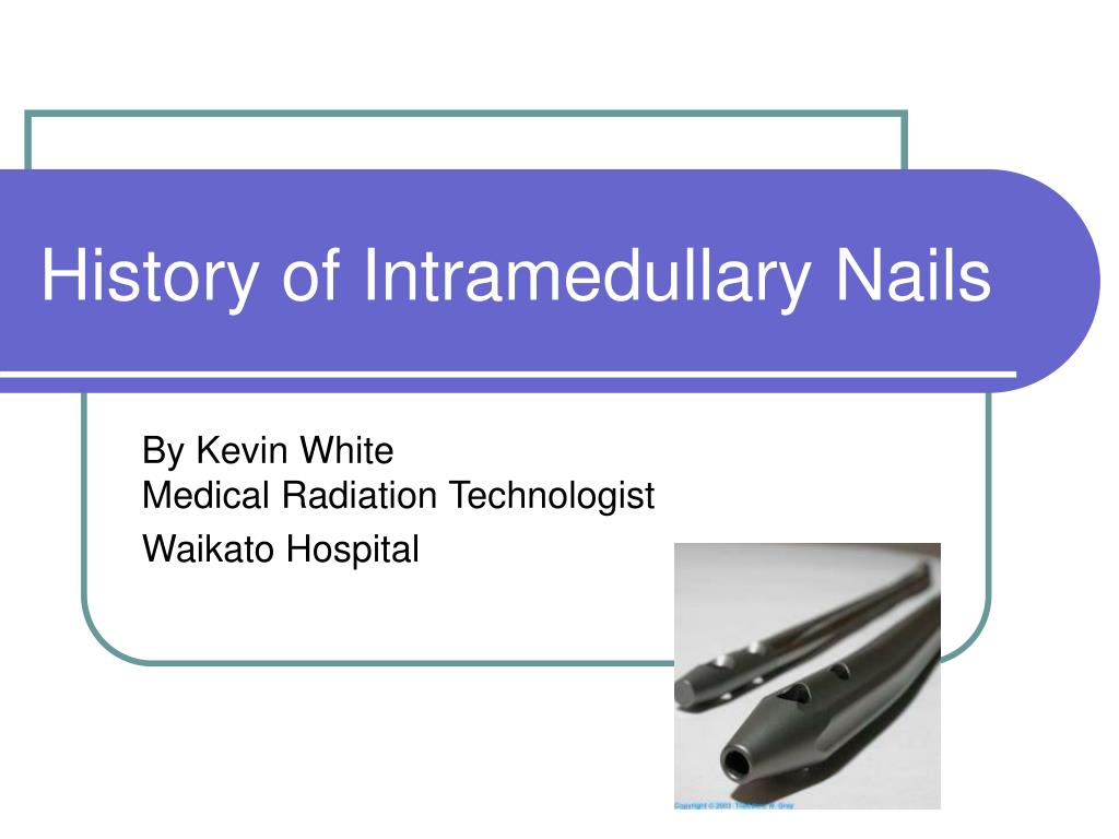 The history of nails - Designing Buildings