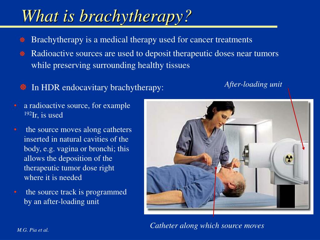 ppt-brachytherapy-at-ist-results-from-an-atypical-comparison-project