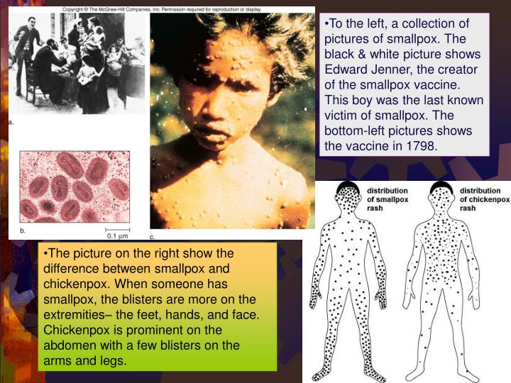 smallpox and different vaccines Correspondence from the new england journal of medicine — an early american smallpox vaccine based on smallpox vaccines from many different sources were. smallpox and different vaccines Correspondence from the new england journal of medicine — an early american smallpox vaccine based on smallpox vaccines from many different sources were.