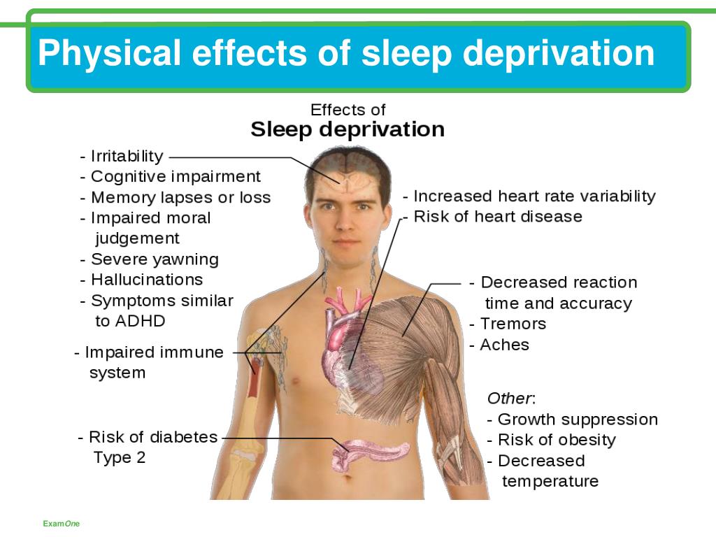powerpoint presentation on sleep deprivation