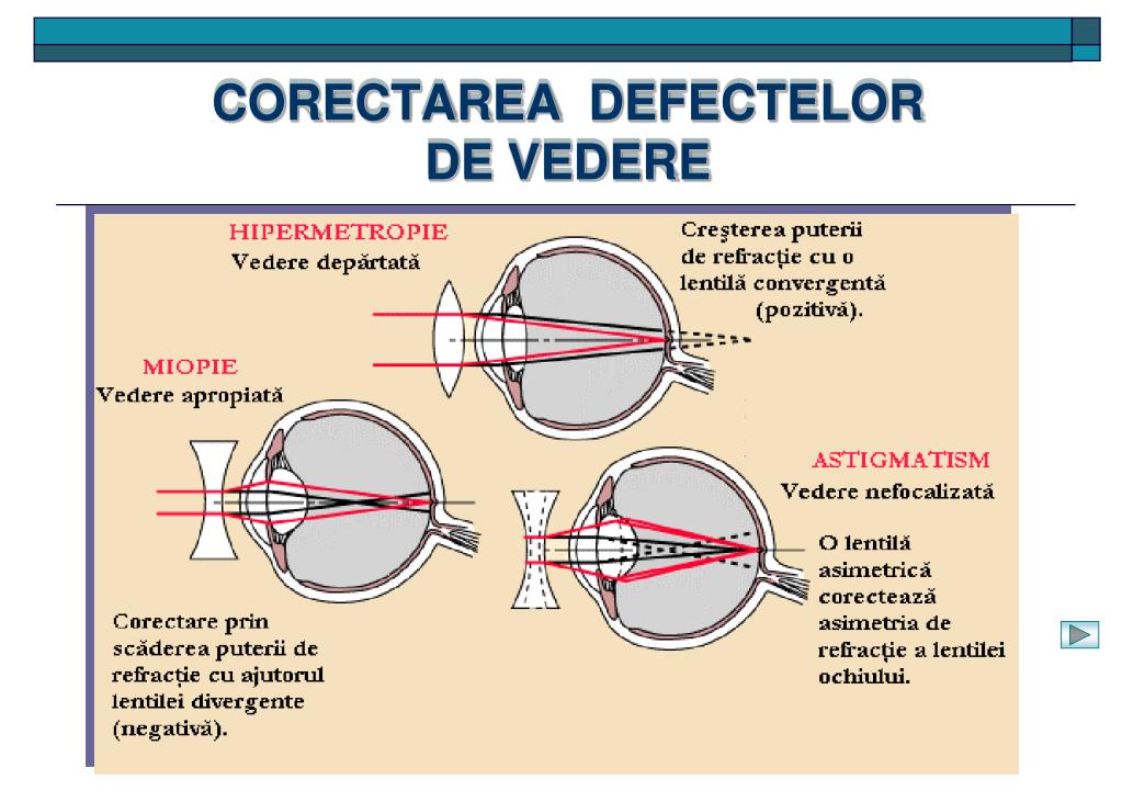scăderea vederii cu astigmatism