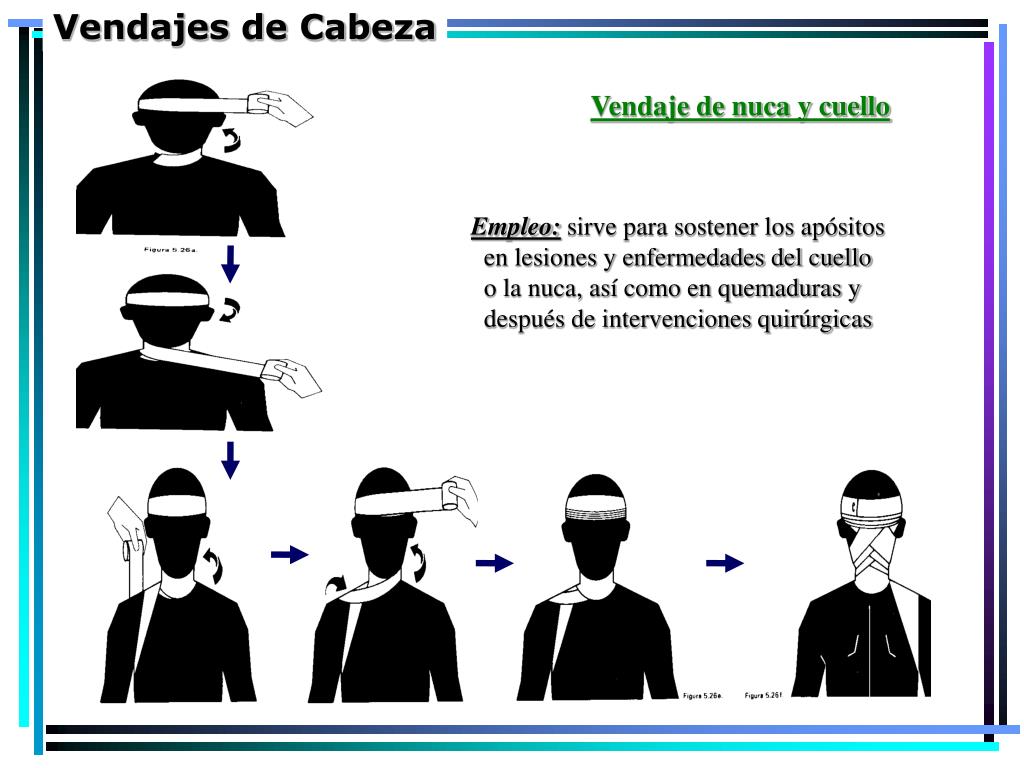 PPT - Vendajes de Cabeza PowerPoint Presentation, free download - ID:1068213