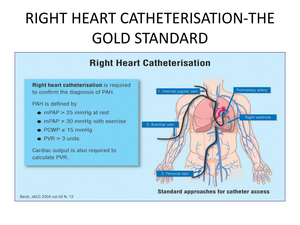 Ppt Pulmonary Hypertension Powerpoint Presentation Free Download