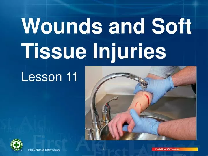 PPT - Wounds and Soft Tissue Injuries PowerPoint Presentation, free ...
