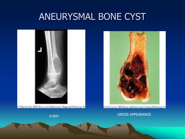 PPT BONES AND MUSCLES PowerPoint Presentation ID 1074073 ppt-bones-and-muscles-powerpoint-presentation-id-1074073