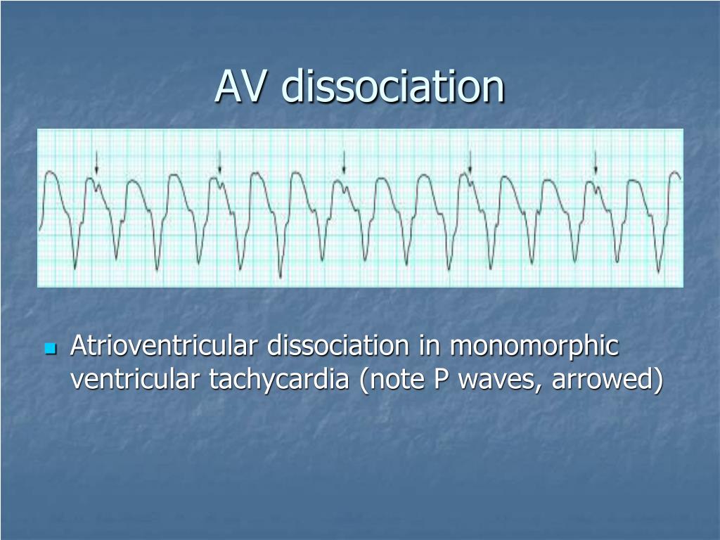 PPT Differential Diagnosis Of Tachycardias PowerPoint Presentation PPT Differential Diagnosis Of Tachycardias PowerPoint Presentation