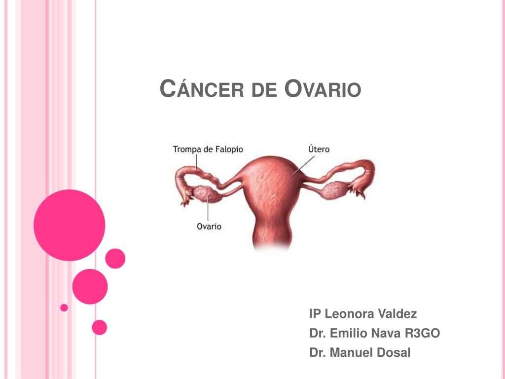 cancer epitelial de ovario slideshare
