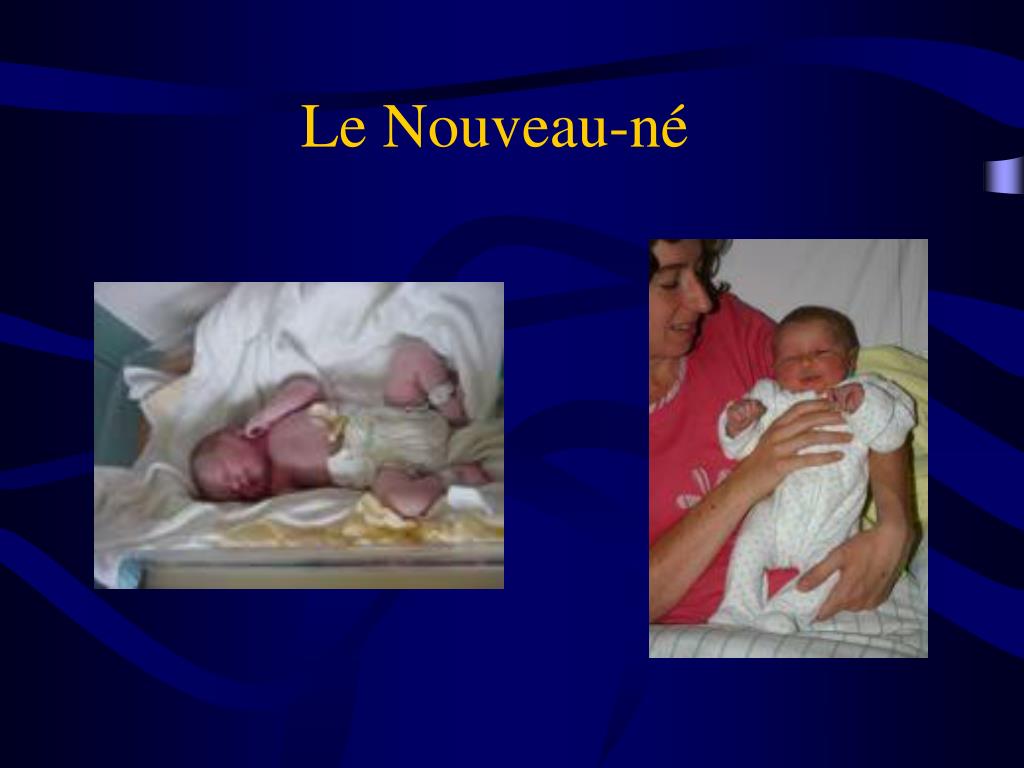 Ppt Developpement Psychomoteur Du Nourrisson Retard Psychomoteur Powerpoint Presentation Id Ppt Developpement Psychomoteur Du Nourrisson Retard Psychomoteur Powerpoint Presentation Id
