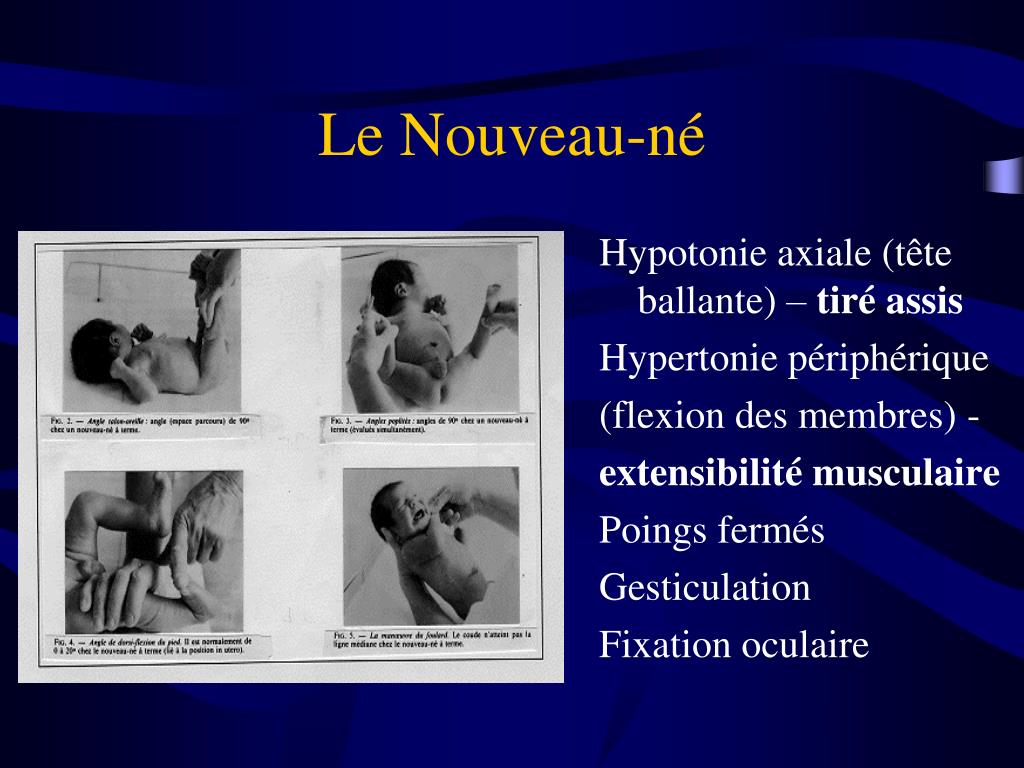 Ppt Developpement Psychomoteur Du Nourrisson Retard Psychomoteur Powerpoint Presentation Id