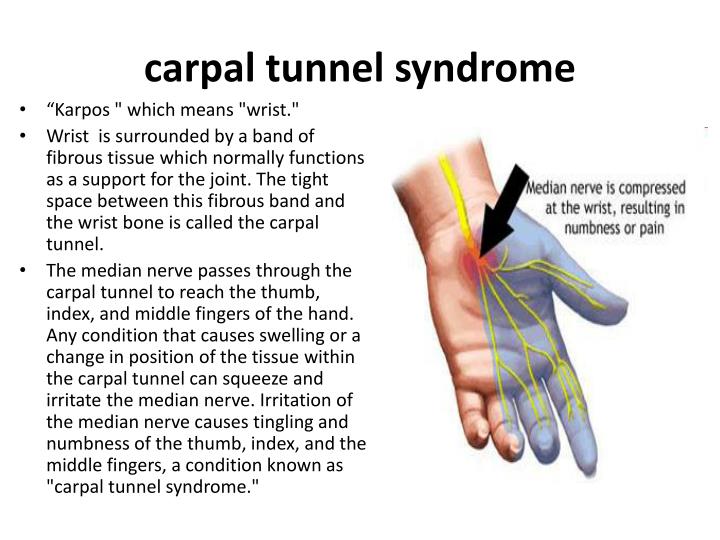 an analysis of the carpal tunnel syndrome in computer users Carpal tunnel syndrome as an occupational disease a meta-analysis by vender et al9 reached the frequency of carpal tunnel syndrome in computer users at a. an analysis of the carpal tunnel syndrome in computer users Carpal tunnel syndrome as an occupational disease a meta-analysis by vender et al9 reached the frequency of carpal tunnel syndrome in computer users at a.