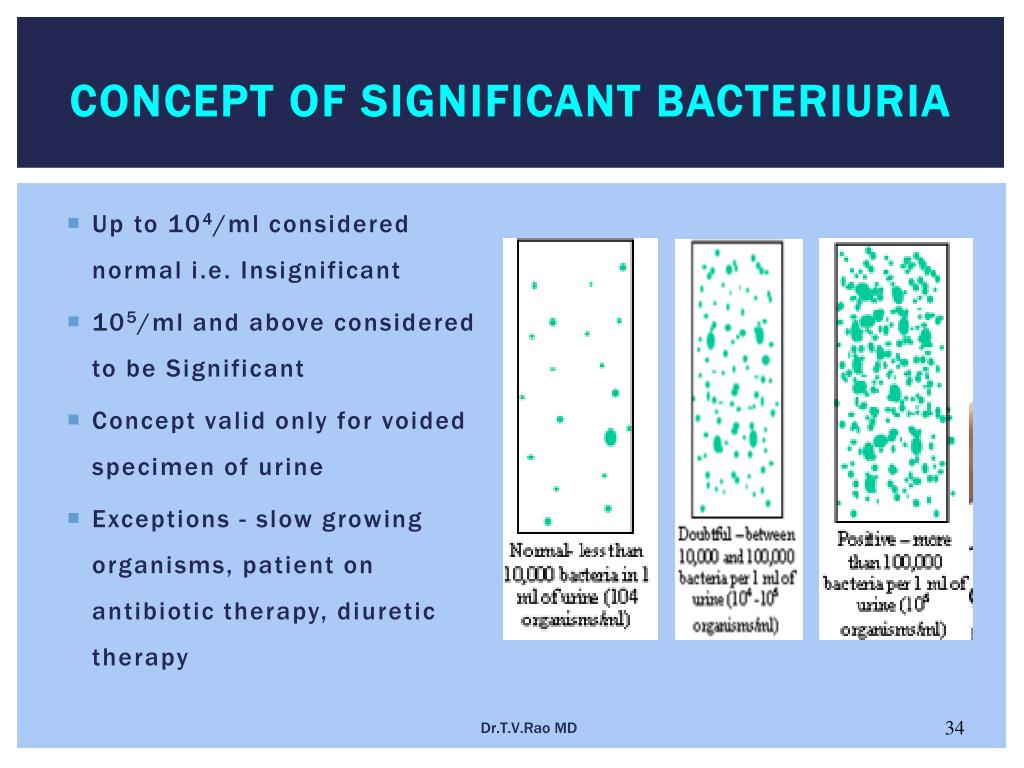 PPT - Culturing of Urine PowerPoint Presentation - ID:111001