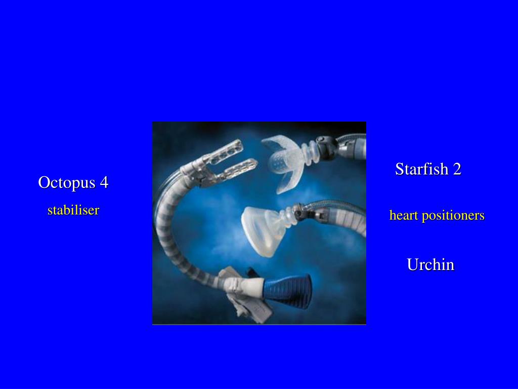PPT - Off Pump and On Pump Coronary Anastomosis Technical ...