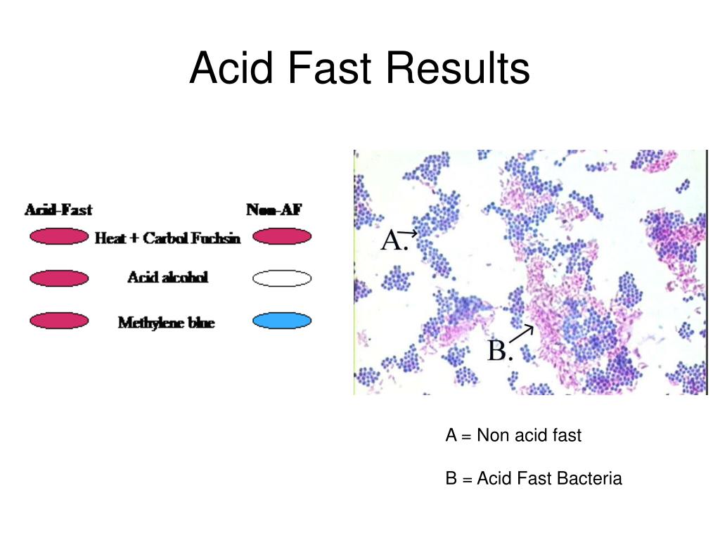 ppt-bacterial-staining-powerpoint-presentation-free-download-id