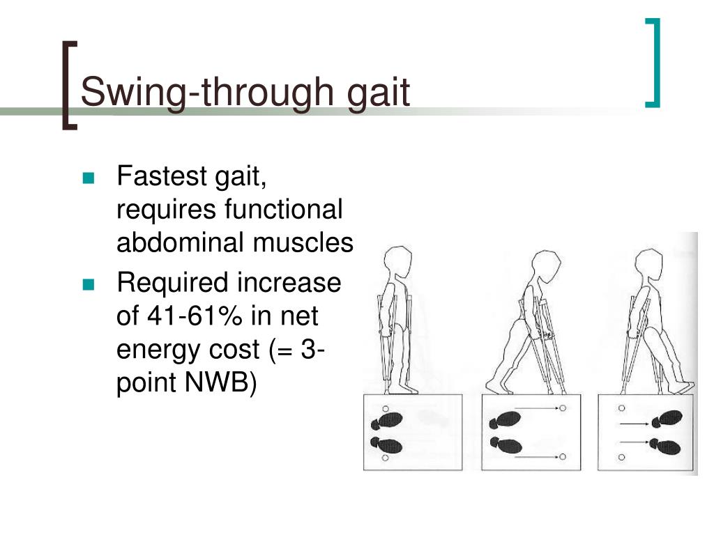 PPT Gait & Gait Aids PowerPoint Presentation, free download ID1120864