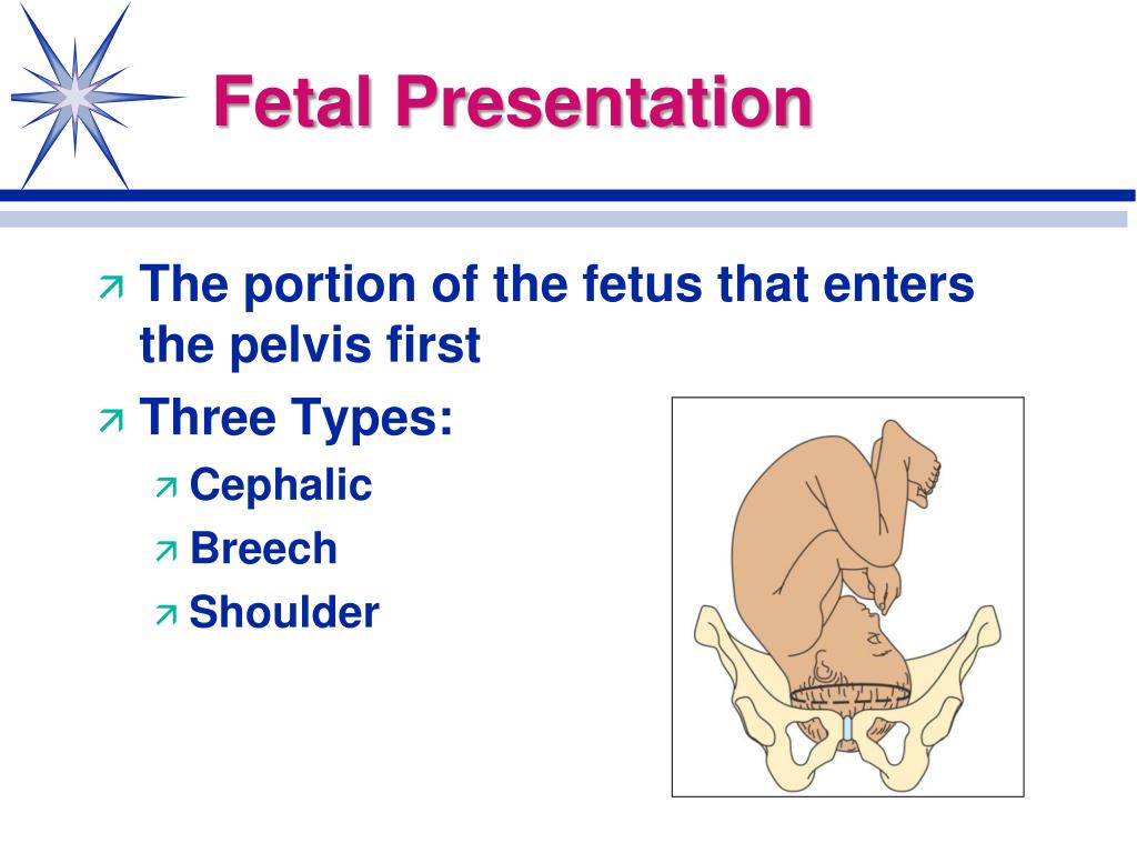 definition of fetal presentation