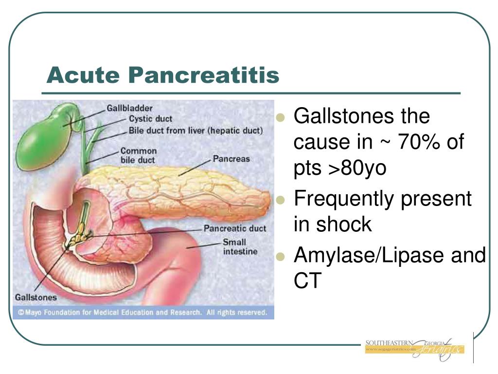 Tiempo de baja por pancreatitis
