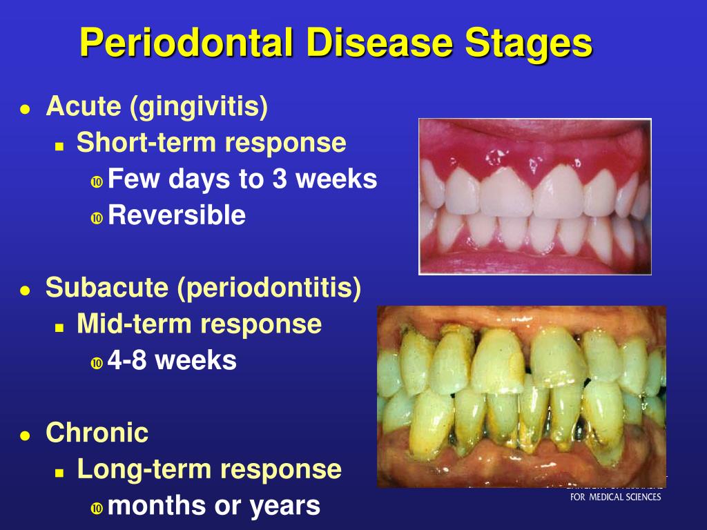 PPT - The Consequences of Oral Disease in the Elderly PowerPoint