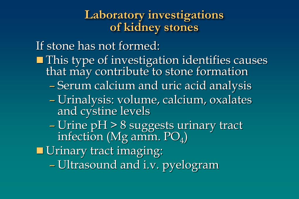 thesis on kidney stones