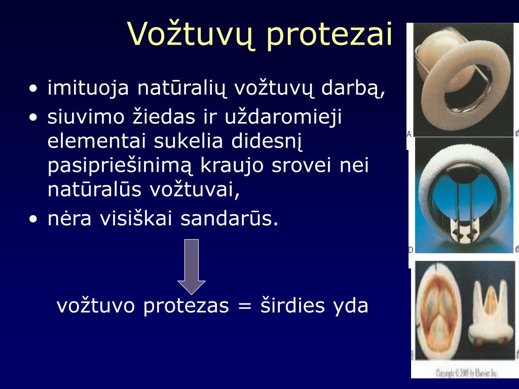 PPT - VO ŽTUVŲ REKONSTRUKCINĖS OPERACIJOS- KARDIOLOGO POŽIŪRIS PowerPoint  Presentation - ID:1133554