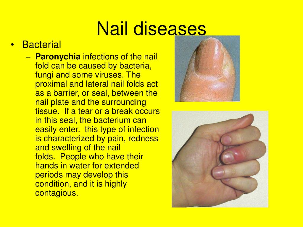 Lateral Nail Folds: Comprehensive Guide To Your Nails