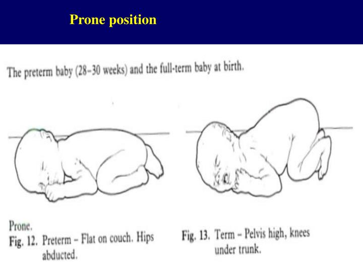 PPT - Psychomotor Development of the Normal Infant PowerPoint ...