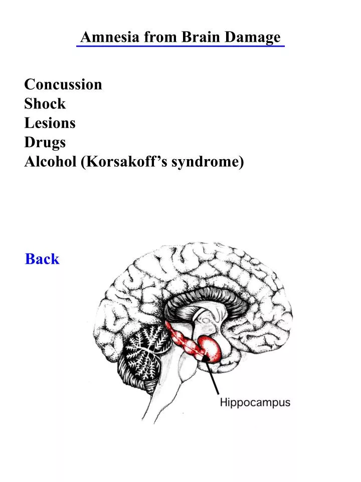 types of amnesia brain injury types of amnesia brain injury