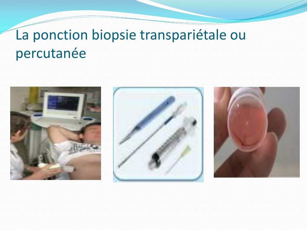Ppt La Ponction Biopsie Hépatique Powerpoint Presentation Free