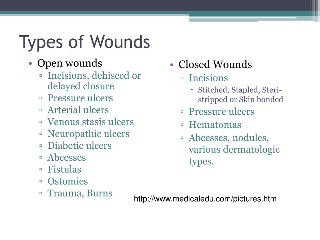 types of wounds powerpoint presentation