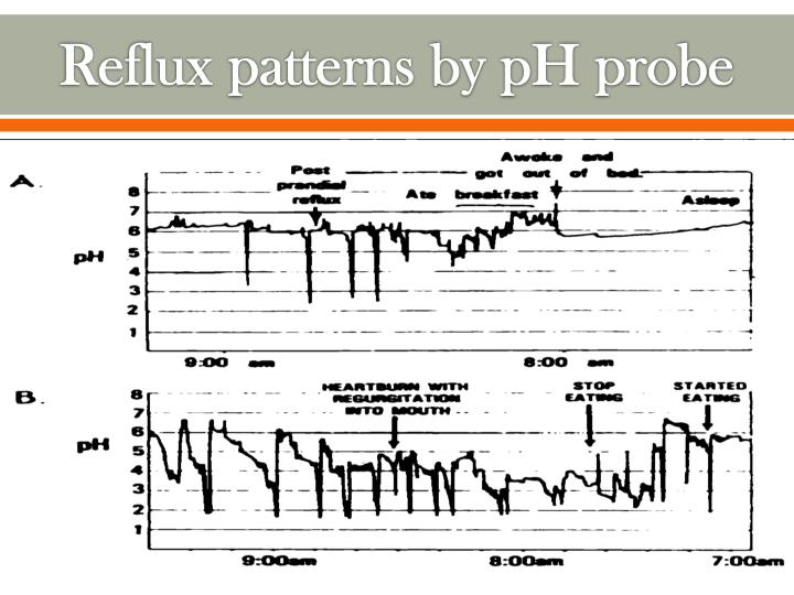 PPT Gastroesophageal Reflux (GER) PowerPoint Presentation ID1166520