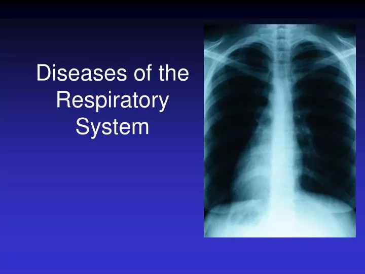 diseases of the respiratory system n.