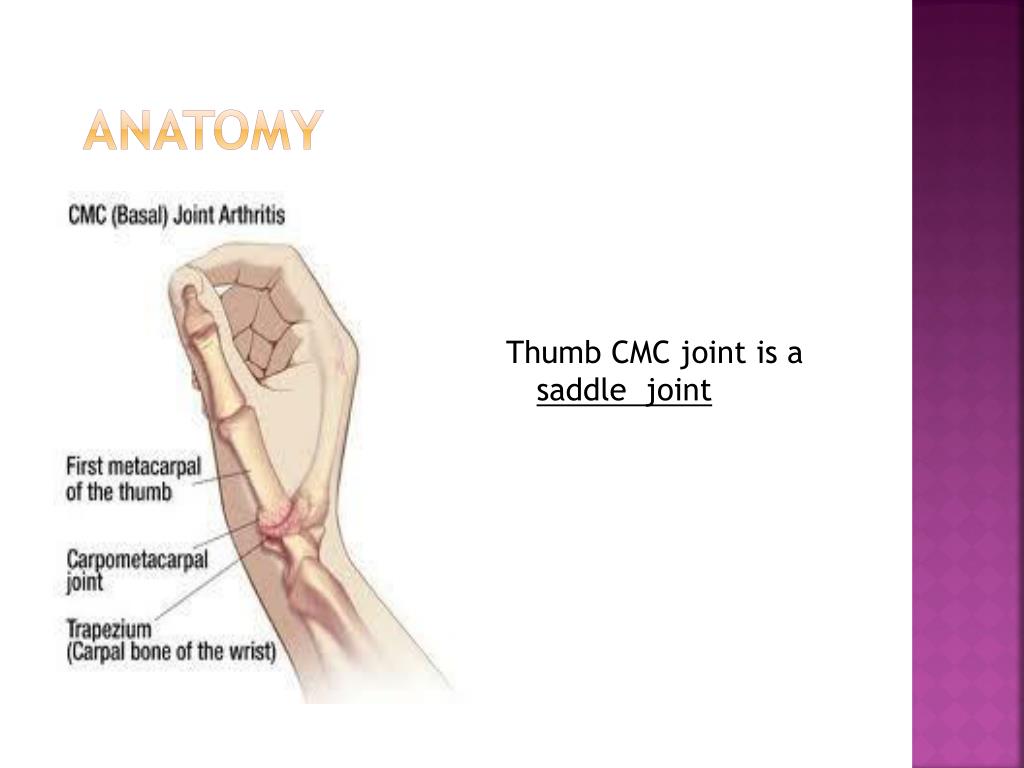 PPT - Occupational therapy and thumb base OA PowerPoint Presentation