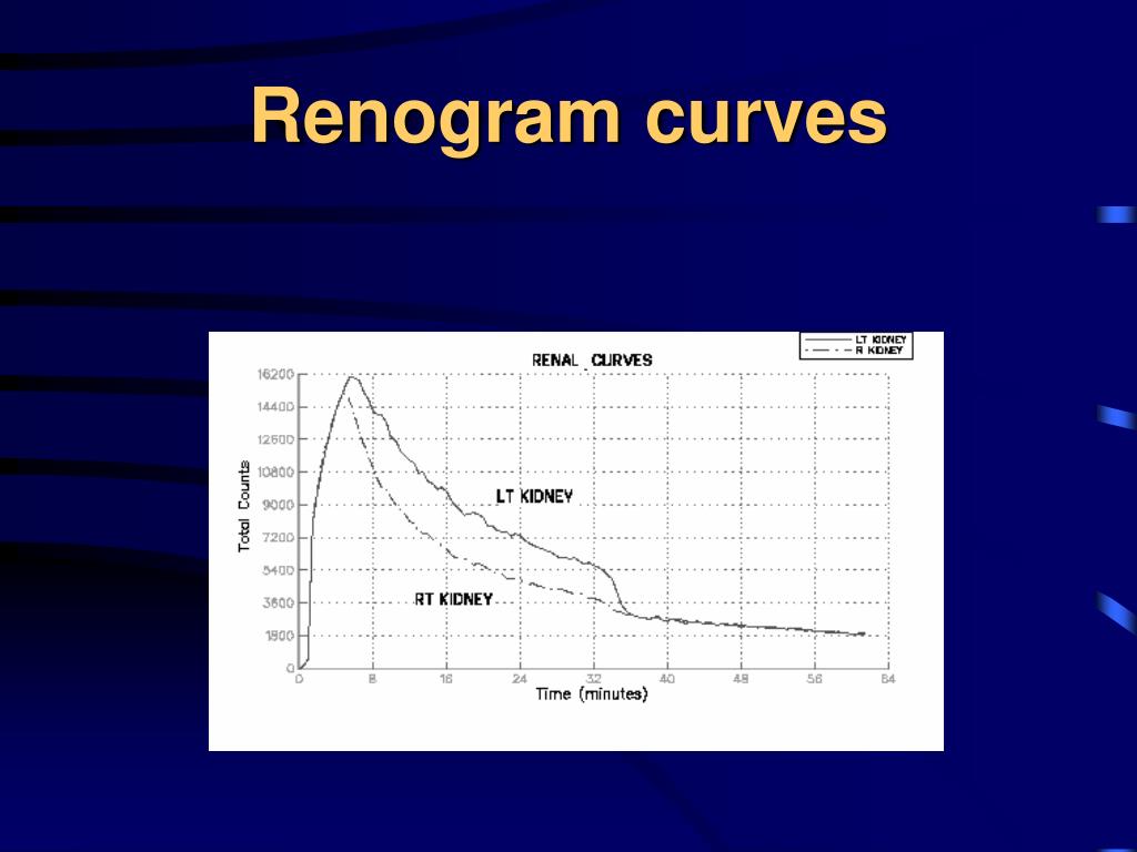 PPT - Renal Scintigraphy PowerPoint Presentation, free download - ID