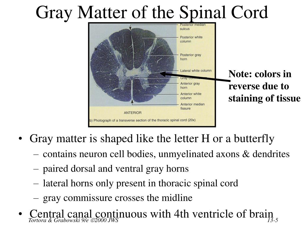 PPT - Chapter 13 The Spinal Cord & Spinal Nerves PowerPoint