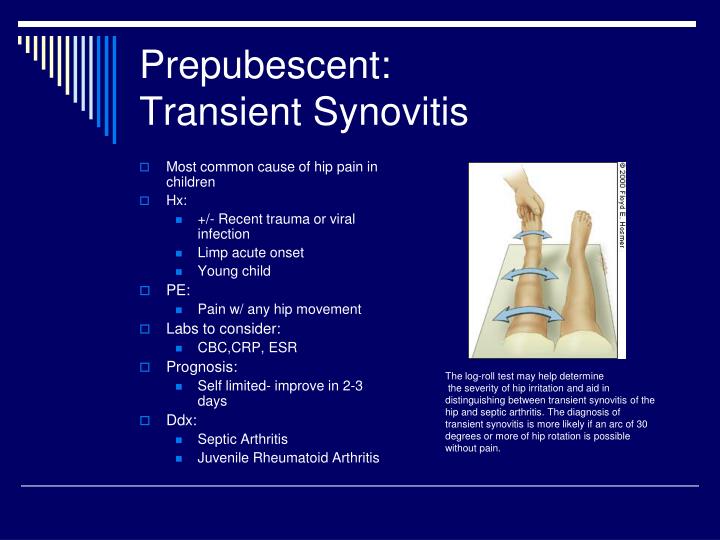 PPT Evaluation of Hip Pain in Children & Young Adults