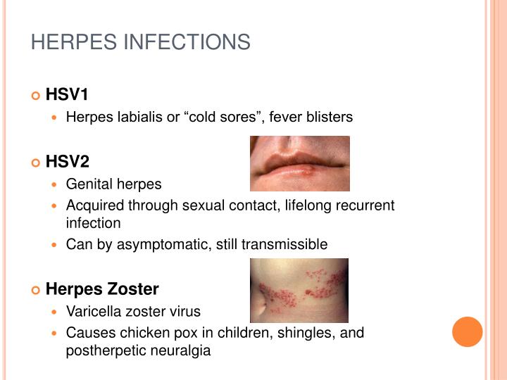 PPT MOST COMMONLY PRESCRIBED ANTIFUNGAL AND ANTIVIRAL MEDICATIONS