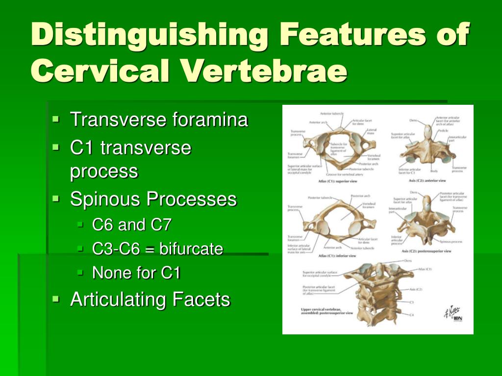 PPT - Cervical Spine Anatomy PowerPoint Presentation, free download