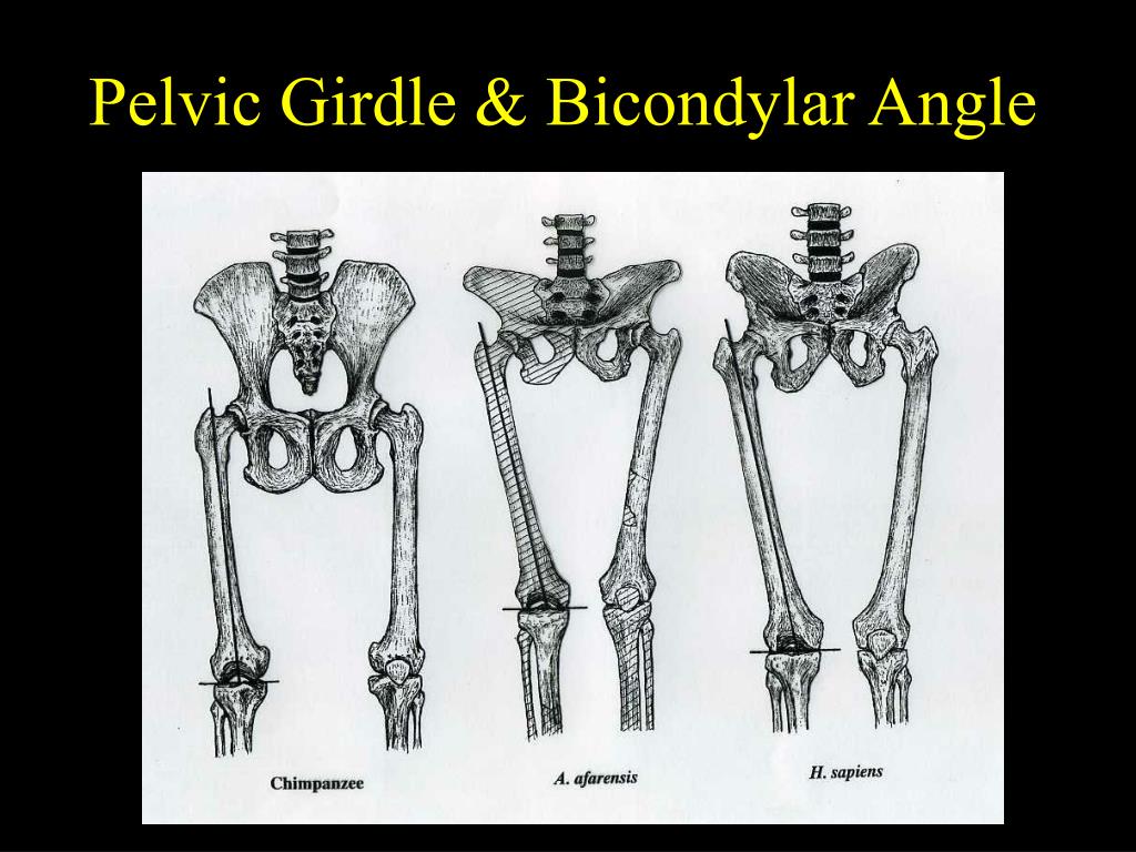Для скелета не характерна. Верхние конечности австралопитека. Femur Bicondylar. Pelvic girdle.