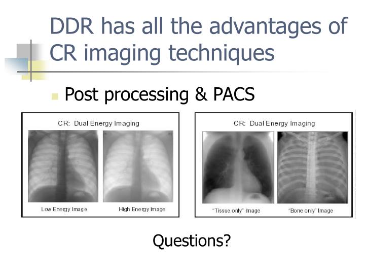 PPT Direct Digital Radiography or Direct Capture Radiography