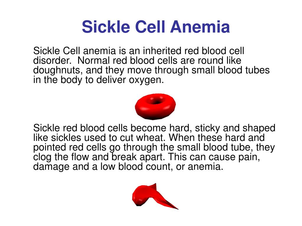 ppt - sickle cell anemia powerpoint presentation - id:1217270