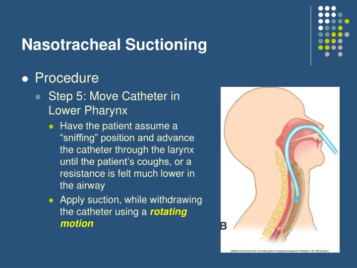 PPT Airway Management Part II PowerPoint Presentation ID1221294