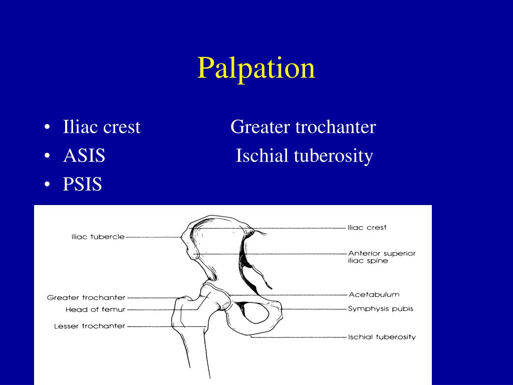 PPT - Hip - Anatomy PowerPoint Presentation, free download - ID:1221961