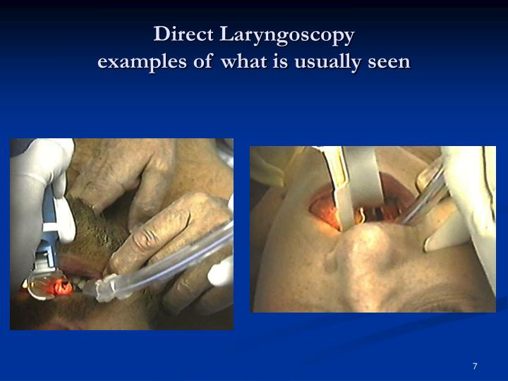 PPT - AIRTRAQ LARYNGOSCOPE PowerPoint Presentation - ID:1224983