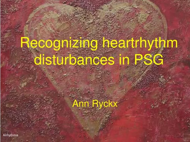 recognizing heartrhythm disturbances in psg n.